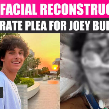 MILF Manor Star Joey Burford's Facial Reconstruction Surgery Post Scooter Crash: Kelle Mortensen Shares Heartfelt Plea For Donations