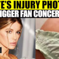 Kate Beckinsale Shares Injury Photos: Fans Express Concern